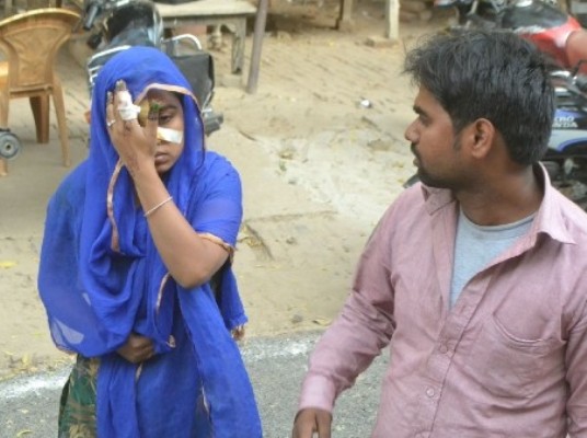 man cuts wife nose