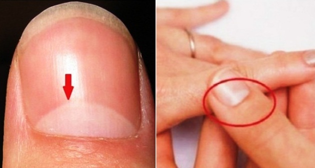 Half Moon Shape on your nails