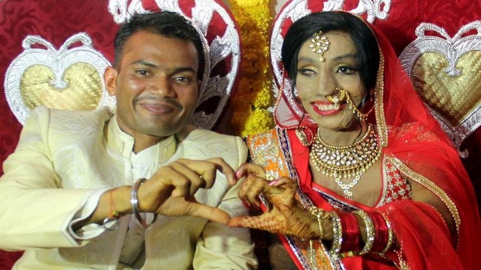 acid attack survivor marriage