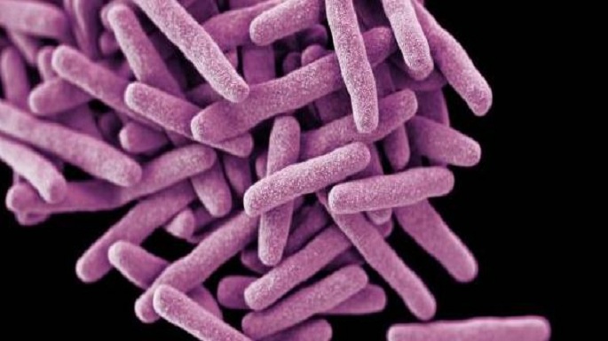 drug resistant tuberculosis