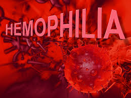 hemophilia